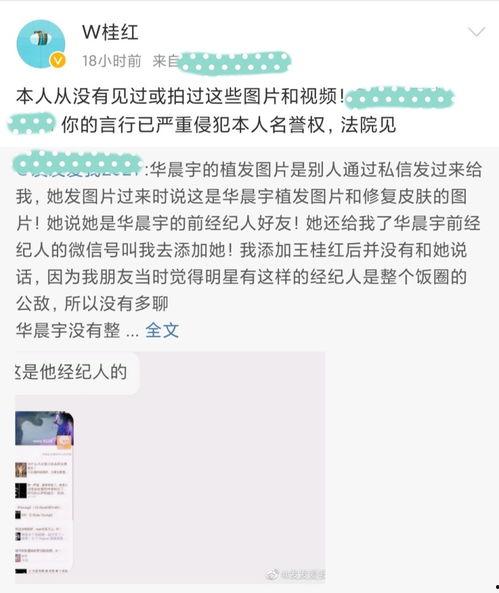 娱乐吃瓜大合集完整,揭秘明星幕后故事，吃瓜大合集全解析